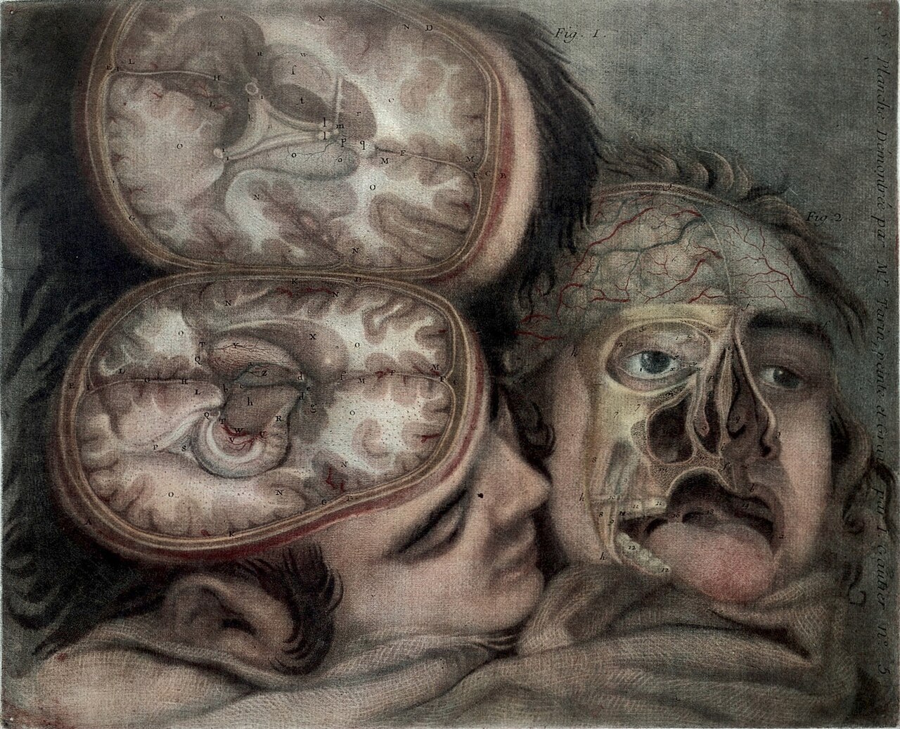 Eighteenth-century anatomical plate showing two dissected human heads